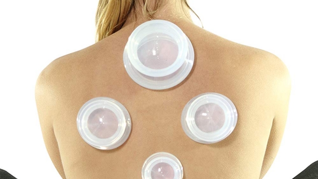 The Benefits of Massage Cupping Therapy